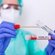 Өлкөдө соңку аптада 13 адам коронавирус жуктуруп алды