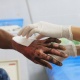 Өзгөндө 36 жаштагы жаран моюнунан жана колунан күйүк алды