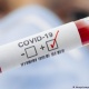 25-апрелге карата 7 адамдан COVID-19 илдети аныкталды