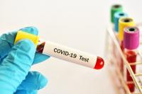 Айдын алгачкы күнү 1 адамдан COVID-19 илдети аныкталды