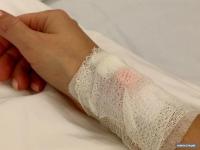 Чүйдө директордун коркутуусунан улам медайым кан тамырларын кести