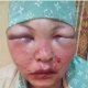 Күйөөсүнөн таяк жеген караколдук келин жардамга муктаж. Аны тез арада Бишкек шаарына алып келүү зарыл болууда