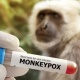 Өлкөгө маймыл чечеги илдетинин келүү коркунучу барбы? Министрлик жооп берди