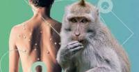Орусияда маймыл чечеги оорусунун алгачкы учуру катталды. Бейтап Европадан келген