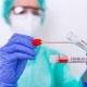 Өлкөдө ПЧР-тест тапшыруунун баасы арзандады