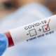 Кыргызстанда акыркы бир жумада COVID-19 илдети 119 адамдан аныкталды