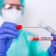 Өлкөдө соңку аптада 22 адам коронавирус жуктуруп алды